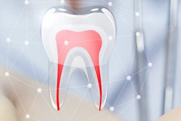 Expert Root Canal Treatment Services in Singapore